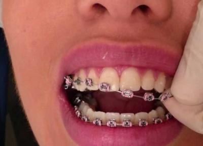 اولین ویزیت ارتودنسی بچه ها خود را جدی بگیرید